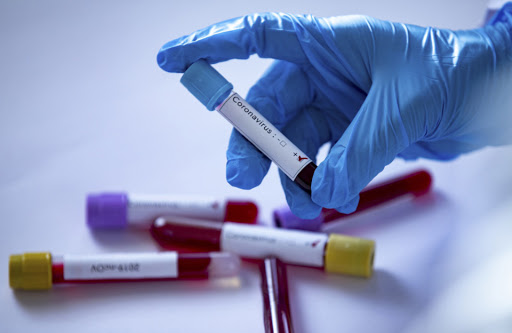 На Любарщині – 21 новий підтверджений випадок захворювання на коронавірус